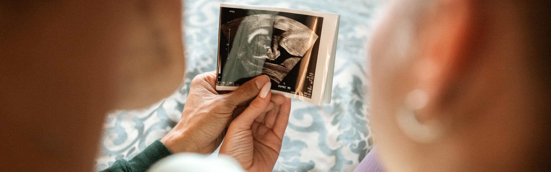 Par tittar på bild från ultraljud. Par tittar på bild från ultraljud.