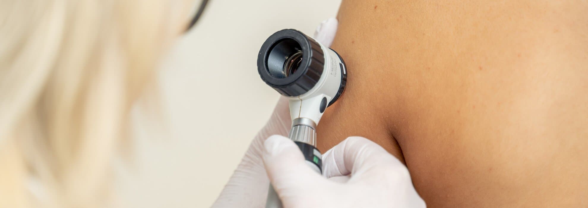 Läkare undersöker hud Läkare undersöker hud