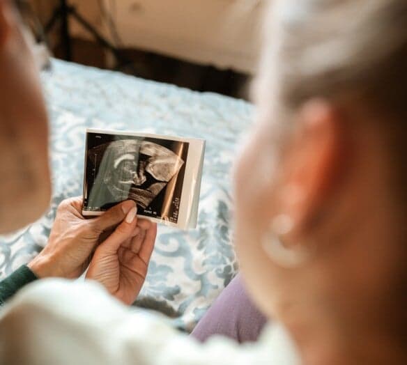 bild på ultraljud bild på ultraljud