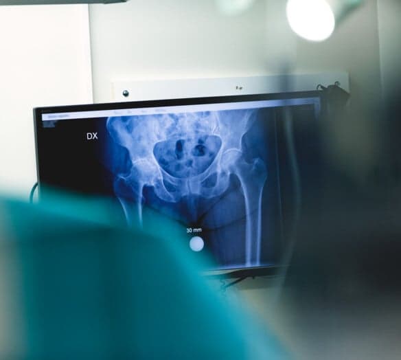 röntgenbild röntgenbild