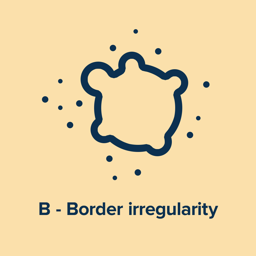 B - Border irregularity B - Border irregularity